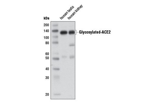 Western blot analysis of extracts from human testis and kidney tissue using ACE2 Antibody.