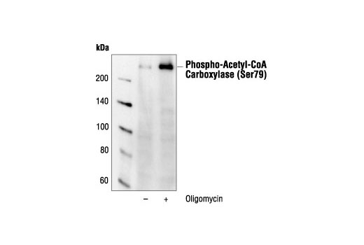 Western blot analysis of extracts from HEK293 cells, untreated or oligomycin-treated, using Phospho-Acetyl-CoA Carboxylase (Ser79) Antibody.