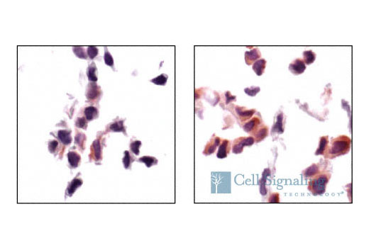 Immunohistochemical analysis of paraffin-embedded NIH/3T3 cells, untreated (left) or serum-starved (right), using Phospho-Acetyl-CoA Carboxylase (Ser79) Antibody.