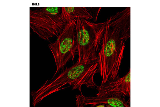 Confocal immunofluorescent analysis of HeLa cells using Acinus Antibody (green). Actin filaments were labeled with DY-554 phalloidin (red).