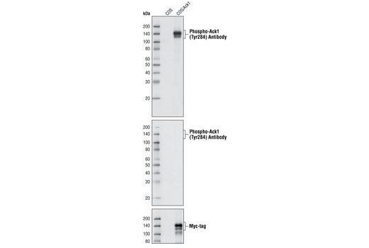 Western blot analysis of extracts from COS cells, untransfected or overexpressing Myc-tagged Ack1 protein, using Phospho-Ack1 (Tyr284) Antibody (upper and middle) and Myc-Tag (71D10) Rabbit mAb #2278 (lower). The middle blot was treated with calf intestinal phosphatase (CIP) before antibody probing. (The lysates of COS cells overexpressing Myc-tagged Ack1 were kindly provided by Dr. Wannian Yang, Weis Center for Research, Geisinger Clinic.)