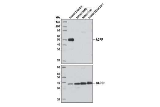 Western blot analysis of extracts from human prostate, testis, liver, and spinal cord using Prostatic Acid Phosphatase (D3Y5P) Rabbit mAb (upper) and GAPDH (D16H11) XP ® Rabbit mAb #5174 (lower) demonstrating prostate-specific expression of ACPP.