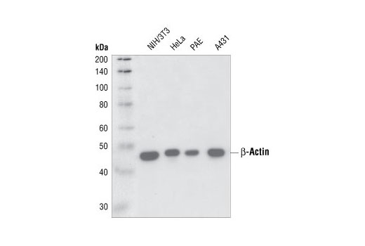 Western blot analysis of cell extracts from various cell lines using beta-Actin (13E5) Rabbit mAb.