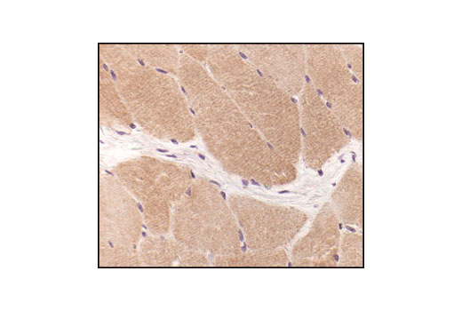 Immunohistochemical analysis of paraffin-embedded human skeletal muscle, using Pan-Actin Antibody.