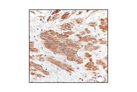 Immunohistochemical analysis of paraffin-embedded human leiomyoma, using Pan-Actin Antibody.