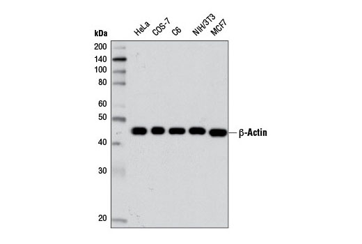 Western blot analysis of extracts from various cell lines using β-Actin (D6A8) Rabbit mAb.
