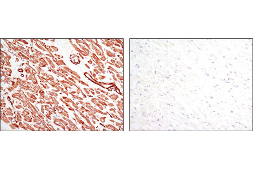 Immunohistochemical analysis of paraffin-embedded human heart using Pan-Actin (D18C11) Rabbit mAb in the presence of control peptide (left) or antigen-specific peptide (right).
