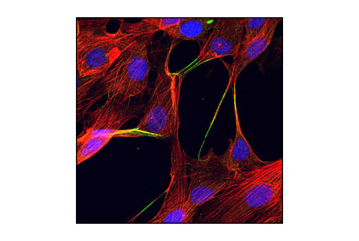 Confocal immunofluorescent analysis of NIH/3T3 cells using alpha-Actinin Antibody (green). Actin filaments have been labeled with Alexa Fluor® 555 phalloidin (red). Blue pseudocolor = DRAQ5™ (fluorescent DNA dye).