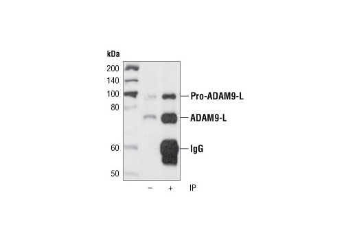 Immunoprecipitation of ADAM9 from HeLa cell extracts using ADAM9 Antibody. Western blot was performed using the same antibody.