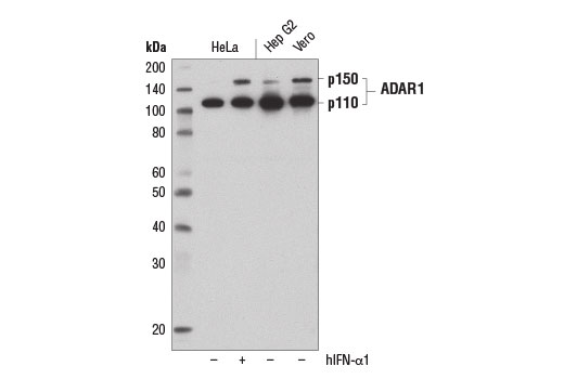 Western blot analysis of extracts from HeLa cells, untreated (-) or treated with hIFN-α1 #8927 (+), and Hep G2 and Vero cells, using ADAR1 (D7E2M) Rabbit mAb.