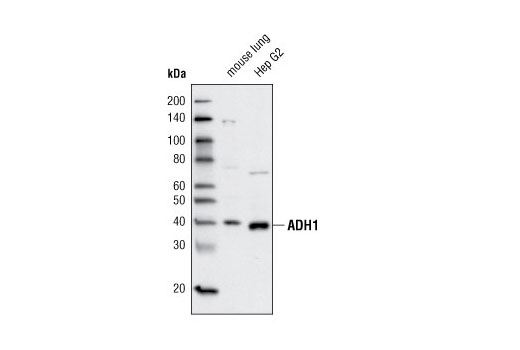 Western blot analysis of extracts from mouse lung and Hep G2 cells using ADH1 Antibody.
