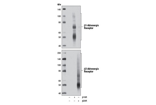 Western blot analysis of extracts from 293T cells, mock transfected (-) or transfected with a construct expressing full-length human β1-Adrenergic Receptor (β1AR; +) or full-length human β2-Adrenergic Receptor (β2AR; +), using β1-Adrenergic Receptor Antibody (upper) or β2-Adrenergic Receptor (D6H2) Rabbit mAb #8513 (lower).