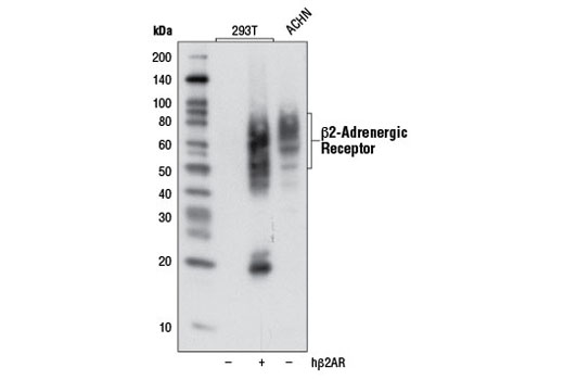 Western blot analysis of ACHN cells or 293T cells, either mock transfected (-) or transfected (+) with a cDNA expression construct encoding human β2-adrenergic receptor (hβ2AR), using β2-Adrenergic Receptor (D6H2) Rabbit mAb.