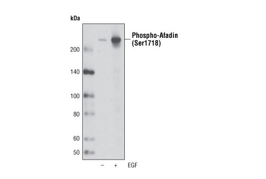 Western blot analysis of extracts from A431 cells, untreated or EGF-treated (100 ng/ml for 5 minutes), using Phospho-Afadin (Ser1718) Antibody.