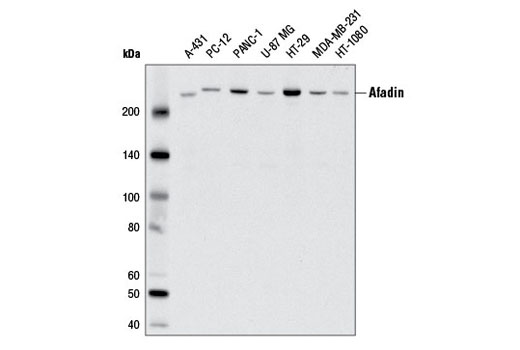 Western blot analysis of extracts from various cell lines using Afadin (D1Y3Z) Rabbit mAb.