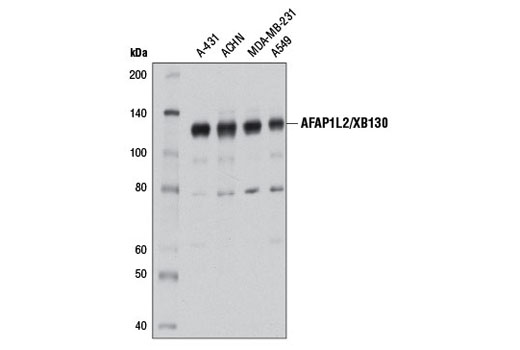 Western Blot analysis of extracts from various cell types using AFAP1L2/XB130 (D1B5) Rabbit mAb.