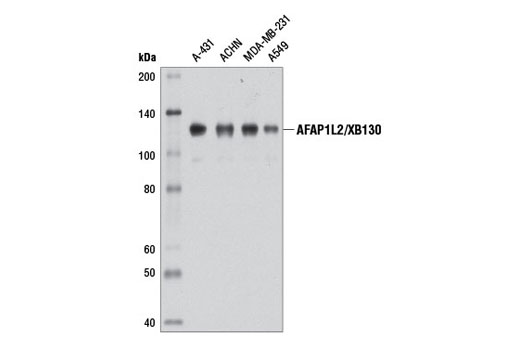 Western Blot analysis of extracts from various cell types using AFAP1L2/XB130 (D4A5) Rabbit mAb.