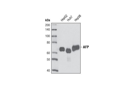 Western blot analysis of extracts of various cell lines using AFP (3H8) Mouse mAb.