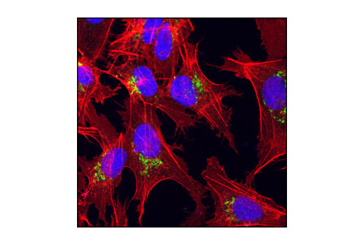 Confocal immunofluorescent analysis of HepG2 cells using AFP Mouse mAb (green). Actin filaments have been labeled with DY-554 phalloidin (red). Blue pseudocolor = DRAQ5 ® #4084 (fluorescent DNA dye).