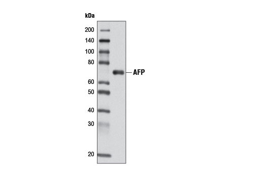 Western blot analysis of extracts from Hep G2 cells using AFP (D12C1) Rabbit mAb.