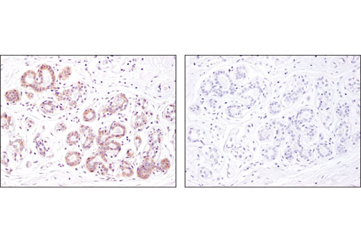 Immunohistochemical analysis of paraffin-embedded human breast using Argonaute 1 (D84G10) XP ® Rabbit mAb in the presence of control peptide (left) or antigen-specific peptide (right).