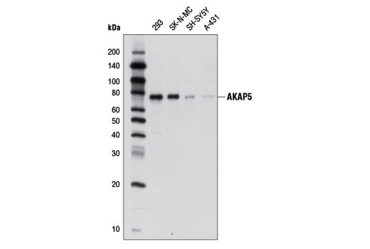 Western blot analysis of extracts from various cell lines using AKAP5 (D28G3) Rabbit mAb.