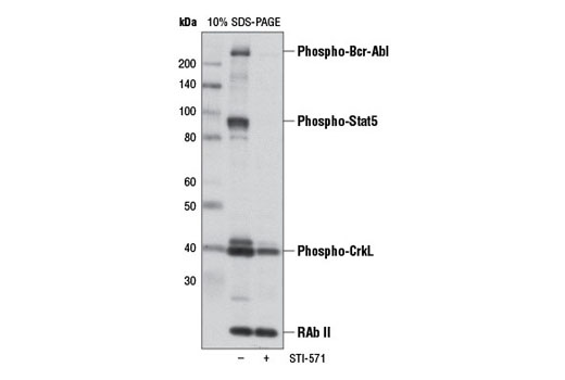  Western blot analysis of extracts from K562 cells untreated or STI-571 treated, using PathScan Bcr/Abl Activity Assay cocktail.