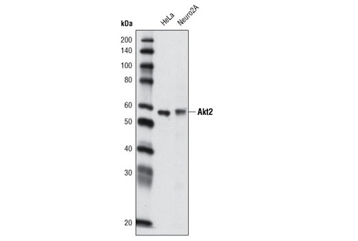 Western blot analysis of extracts from HeLa and Neuro2A cells using Akt2 (L79B2) Mouse mAb.