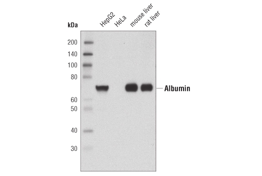 Western blot analysis of extracts from mouse and rat liver as well as HepG2 and HeLa cell extracts using Albumin Antibody.