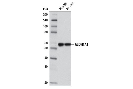 Western blot analysis of extracts from Hep 3B and Hep G2 cells using ALDH1A1 (D4R9V) Rabbit mAb.