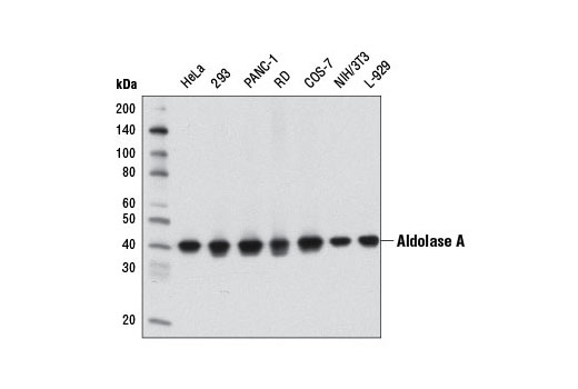 Western blot analysis of extracts from various cell lines using Aldolase A (D73H4) Rabbit mAb.