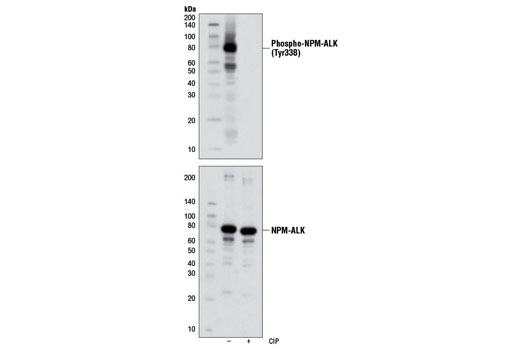 Western blot analysis of extracts from SUP-M2 cells, untreated or treated with calf intestinal phosphatase (CIP), using Phospho-ALK (Tyr1278) (D59G10) Rabbit mAb (upper) and ALK (C26G7) Rabbit mAb #3333 (lower).