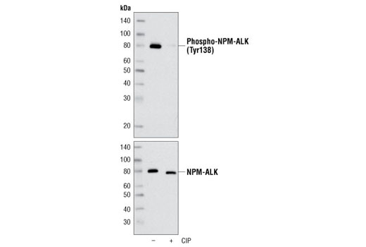 Western blot analysis of extracts from KARPAS-299 cells, untreated or treated with calf intestinal phosphatase (CIP), using Phospho-ALK (Tyr1078) Antibody (upper) and ALK (C26G7) Rabbit mAb #3333 (lower). Cell Line Source: Dr Abraham Karpas at the University of Cambridge.