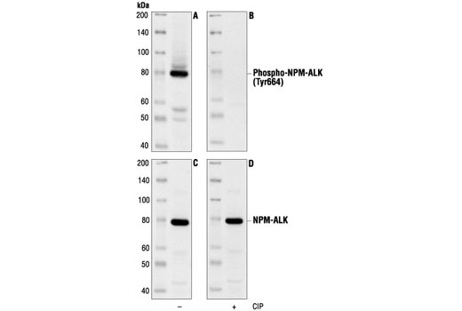 Western blot analysis of extracts from Sup-M2 cells, using Phospho-ALK (Tyr1604) Antibody (A,B) or ALK Antibody (C,D). The phospho-specificity of the antibody was characterized by treating the membrane with calf intestinal alkaline phosphatase (CIP) (B,D) after Western transfer. (Sup-M2 cells provided by Dr. Stephan W. Morris, St. Jude Children's Research Hospital, Tennessee.)