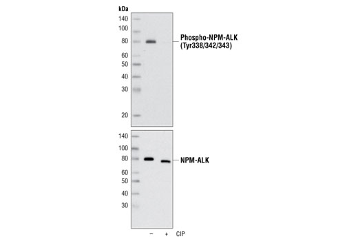 Western blot analysis of extracts from KARPAS-299 cells, untreated or treated with calf intestinal phosphatase (CIP), using Phospho-ALK (Tyr1278/1282/1283) Antibody (upper) and ALK (C26G7) Rabbit mAb #3333 (lower). Cell Line Source: Dr Abraham Karpas at the University of Cambridge.