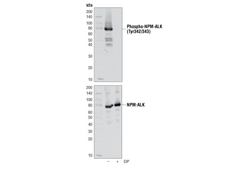 Western blot analysis of extracts from SUP-M2 cells, untreated or treated with calf intestinal phosphatase (CIP), using Phospho-ALK (Tyr1282/1283) (D39B2) Rabbit mAb (upper) or ALK (C26G7) Rabbit mAb #3333 (lower). The lower molecular weight cluster is partial degradation of the ALK fusion.