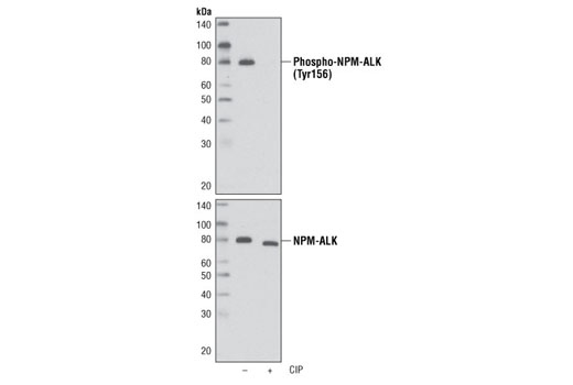Western blot analysis of extracts from KARPAS-299 cells, untreated or treated with calf intestinal phosphatase (CIP), using Phospho-ALK (Tyr1096) Antibody (upper) and ALK (C26G7) Rabbit mAb #3333 (lower). Cell Line Source: Dr Abraham Karpas at the University of Cambridge.