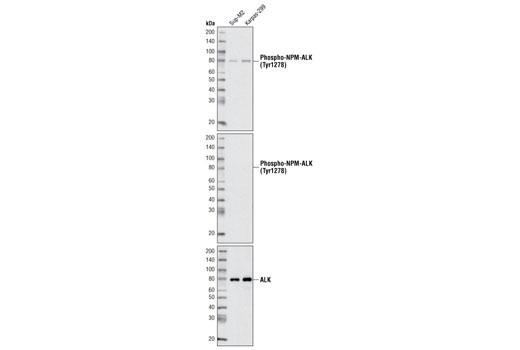Western blot analysis of extracts from Sup-M2 and Karpas-299 cells using Phospho-ALK (Tyr1278) Antibody (upper and middle) and ALK (C26G7) Rabbit mAb #3333 (lower). The middle and lower blots were treated with calf intestinal phosphatase to dephosphorylate NPM-ALK. Cell Line Source: Dr Abraham Karpas at the University of Cambridge.