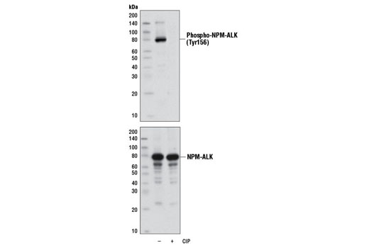 Western blot analysis of extracts from SUP-M2 cells, untreated or treated with calf intestinal phosphatase (CIP), using Phospho-ALK (Tyr1096) (D96H10) Rabbit mAb (upper) and ALK (C26G7) Rabbit mAb #3333 (lower).