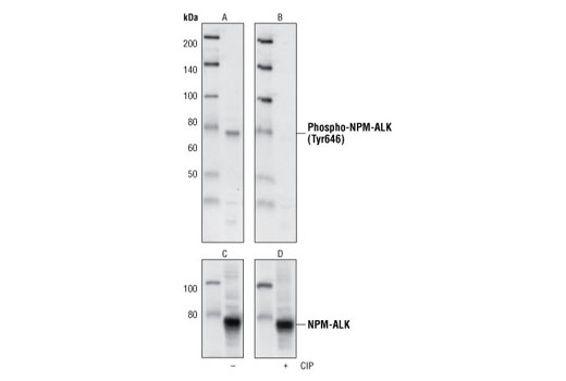 Western blot analysis of Sup-M2 cell lysate, using Phospho-ALK (Tyr1586) (3B4) Rabbit mAb (A and B), and ALK Antibody (C and D).The phospho-specificity of this antibody was characterized by treating the membrane with calf intestinal alkaline phosphatase (CIP) (B and D) after Western transfer.
