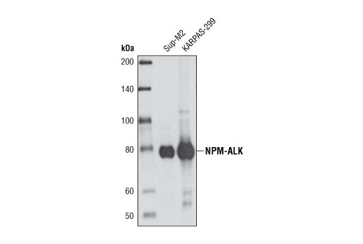 Western blot analysis of extracts from Sup-M2 and KARPAS-299 cells using ALK (31F12) Mouse mAb. Cell Line Source: Dr Abraham Karpas at the University of Cambridge.