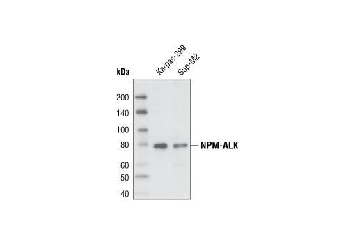 Western blot analysis of extracts from Karpas-299 and Sup-M2 cells using ALK (C26G7) Rabbit mAb. Cell Line Source: Dr Abraham Karpas at the University of Cambridge.