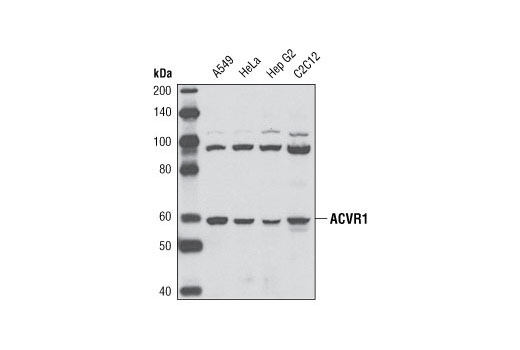 Western blot analysis of extracts from various cell lines using ACVR1 Antibody.