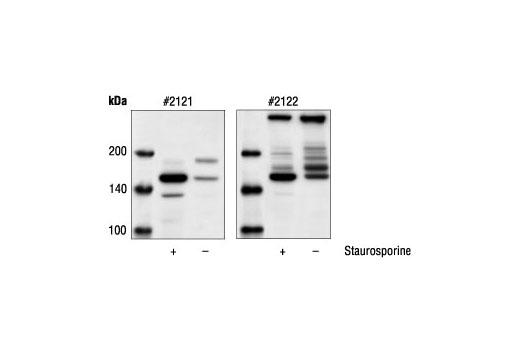 Western blot analysis of extracts from HeLa cells, untreated or staurosporine-treated, using Cleaved alpha-Fodrin (Asp1185) Antibody #2121 (left) and alpha-Fodrin Antibody (right).