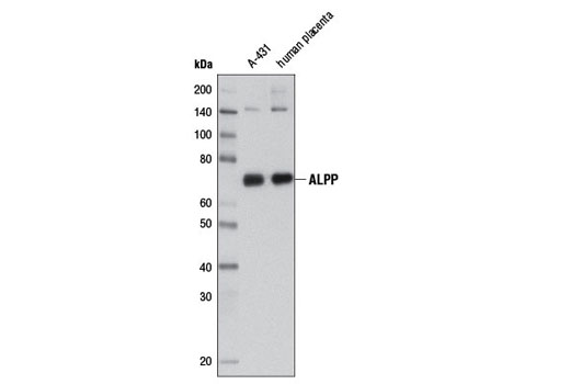 Western blot analysis of extracts from A-431 cells and human placental tissue using ALPP (3E5C7) Mouse mAb.