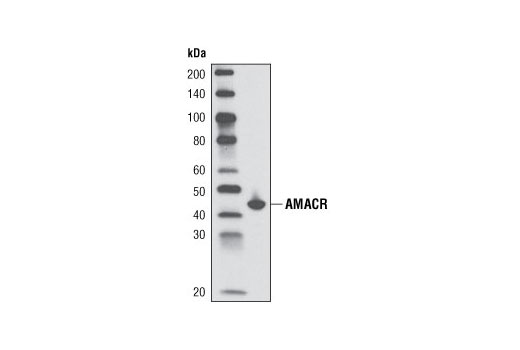 Western blot analysis of extracts from LNCaP cells using AMACR (2A10) Mouse mAb.