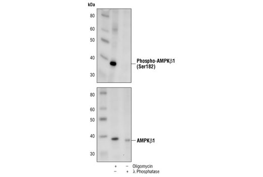Western blot analysis of extracts from oligomycin treated C6 cells or C6 cell lysate treated with λ phosphatase, using Phospho-AMPKβ1 (Ser182) Antibody (upper) and AMPKβ1 Antibody #4182 (lower).