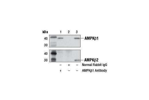 Immunoprecipitation of AMPKβ1 from COS-7 cell extracts using Normal Rabbit IgG #2729 (lane 2) or AMPKβ1 Antibody (lane 1). Lane 3 is 10% input. Western blot analysis was performed using AMPKβ1 Antibody (upper) or AMPKβ2 Antibody #4148 (lower).