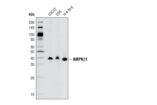 Western blot analysis of extracts from various cell types using AMPKβ1 (71C10) Rabbit mAb.