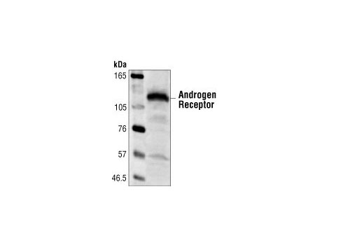 Western blot analysis of extracts from LNCaP cells using Androgen Receptor Antibody.